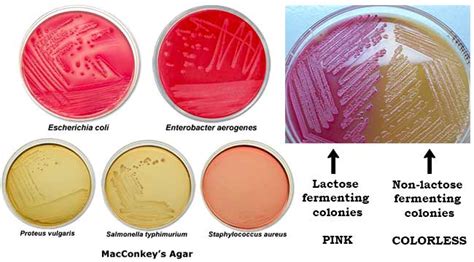 pseudomonas on macconkey agar|12.6.1: MacConkey Agar .